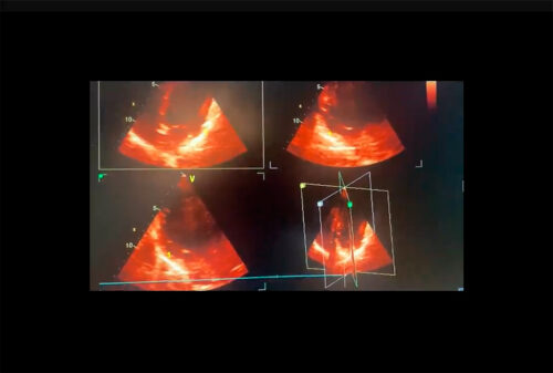 Imagem cardiovascular 2024 (Arquivo Brasileiro de Cardiologia)